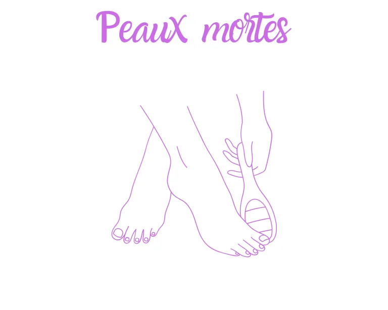 Peaux Mortes