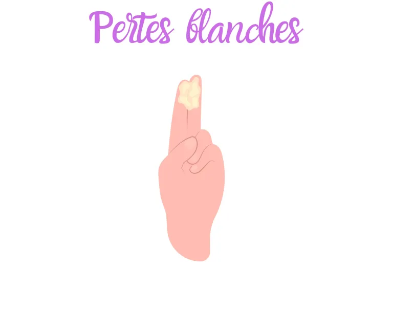 Pertes blanches